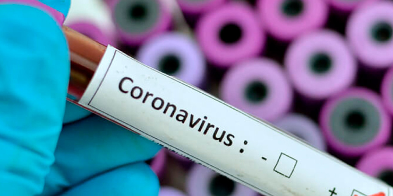 kuva koeputkesta jossa lukee coronavirus